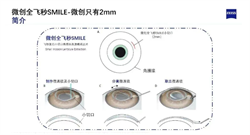 全飞秒4.0-VISULYZE正式落户合肥瑶海普瑞眼科医院！