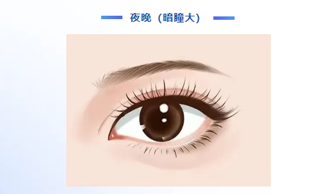 同样做近视手术，为啥有人会眩光？暗瞳是关键