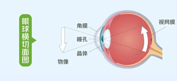 眼睛起雾了?关于白内障,看这一篇就够了!